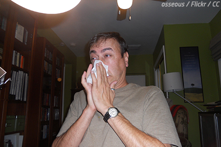 Allergic reaction
